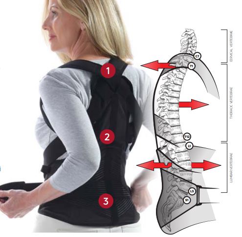 Osteotrap DonJoy tutore osteoporosi Orthofasty